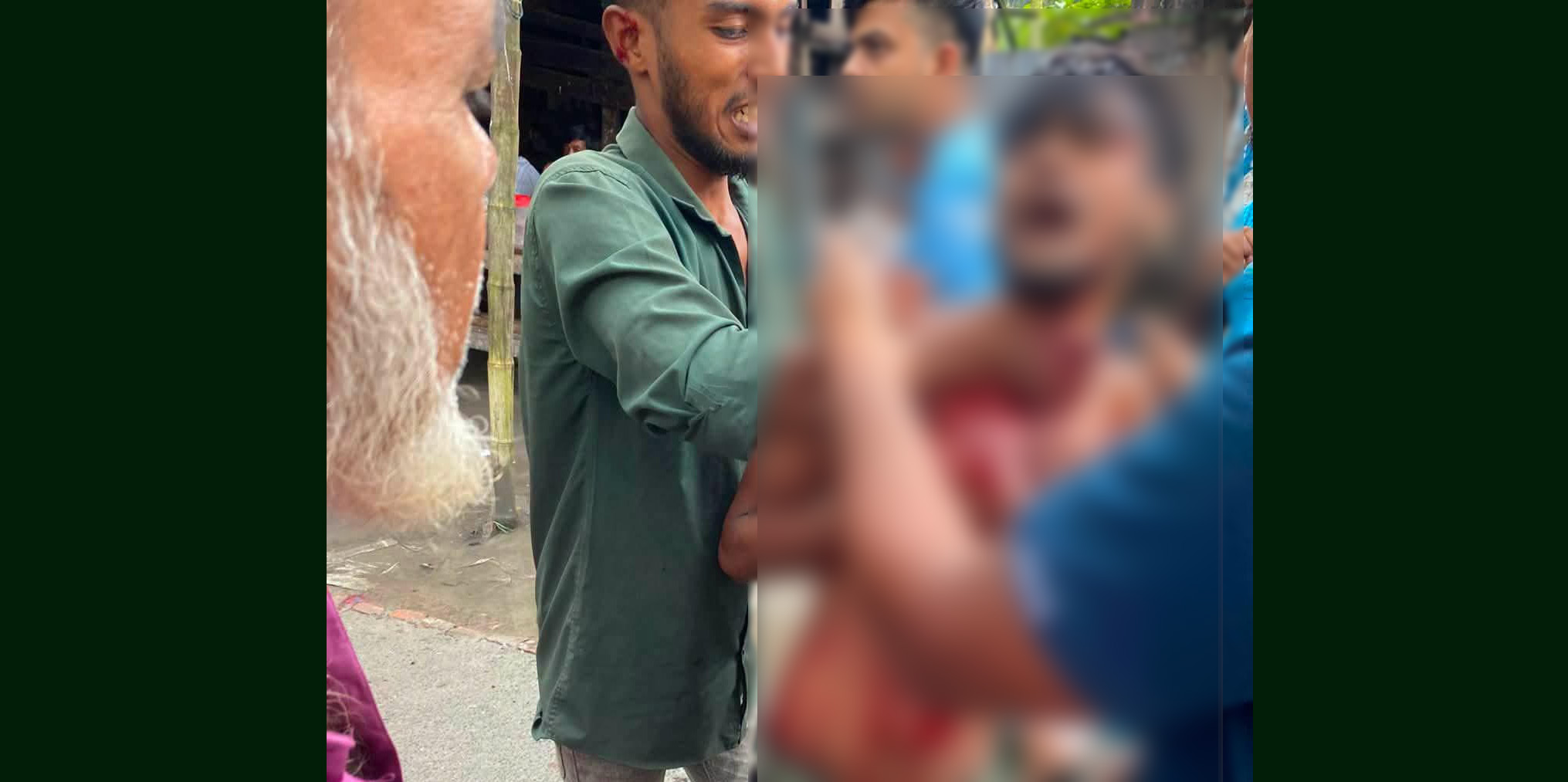 কাঠালিয়ায় তুচ্ছ ঘটনাকে কেন্দ্র করে ছুরিকাঘাতে যুবক আহত, অভিযুক্ত আটক